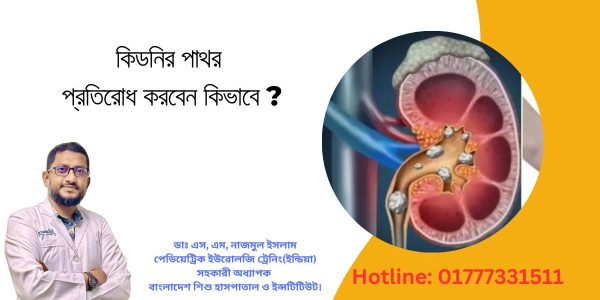 কিডনিতে পাথর প্রতিরোধ