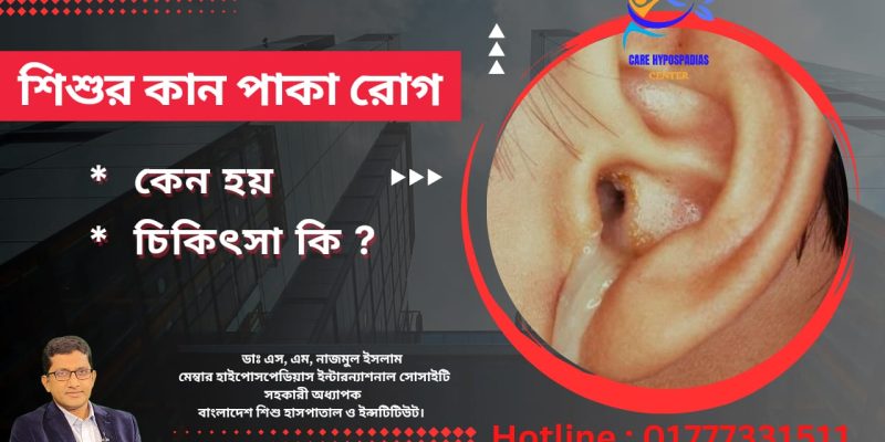 শিশুর কান পাকা রোগ (Otitis Media)