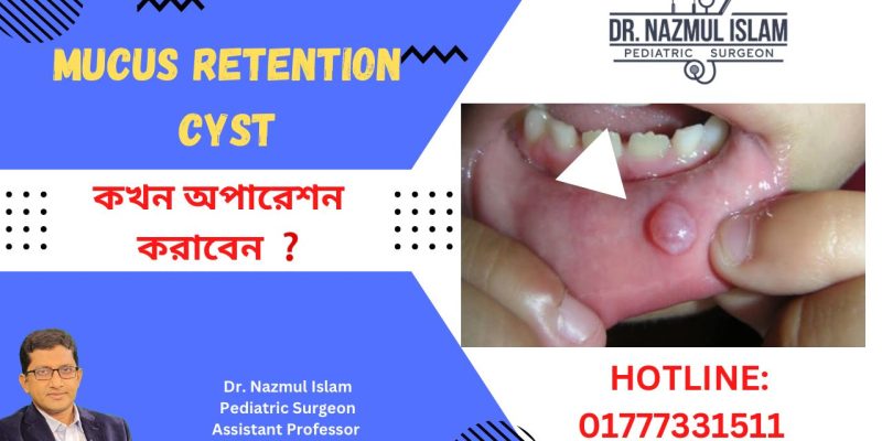 Mucus retention cyst (mucocele)