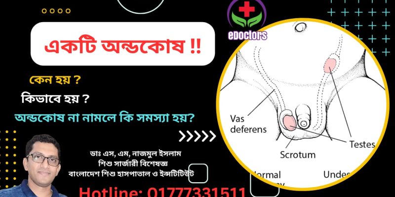 একটি অন্ডকোষ কেন হয়? কিভাবে হয়? অন্ডকোষ না নামলে কি সমস্যা হয়?