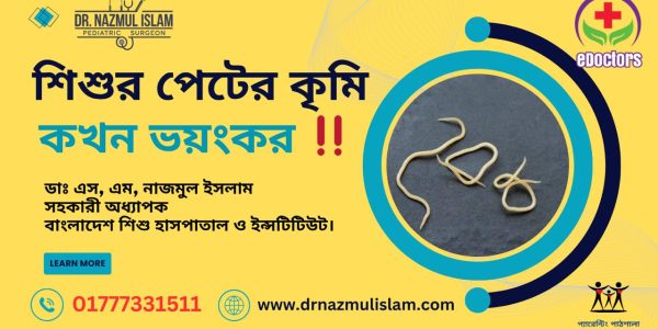 শিশুর পেটে কৃমি: কখন অপারেশন লাগতে পারে